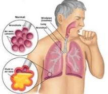 penyakit paru paru basah